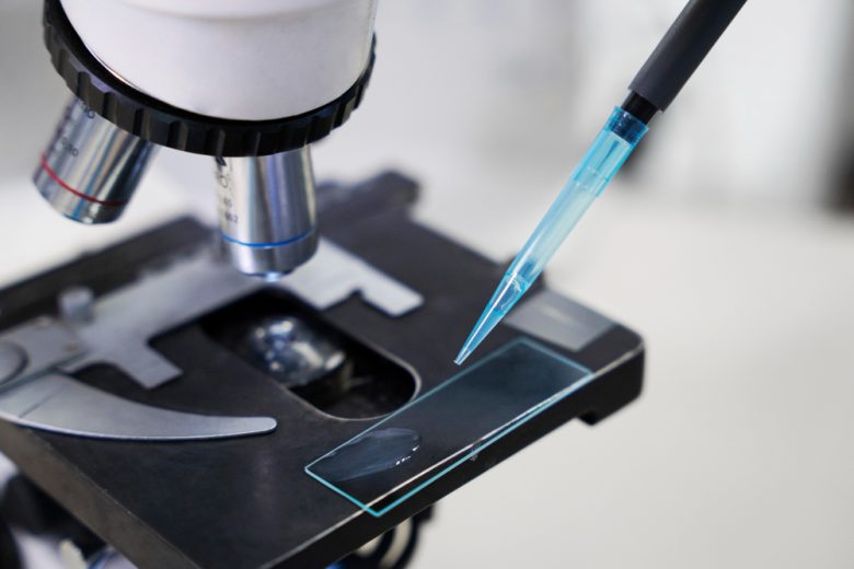 intracytoplasmic sperm injection procedure